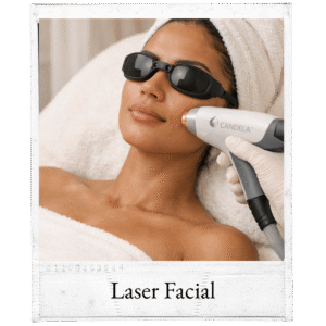 Candela Laser Facial