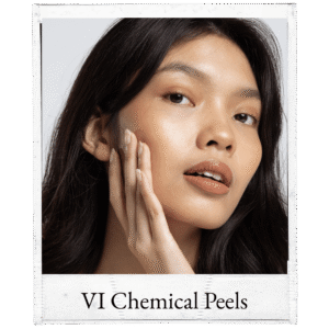 VI Chemical Peel
